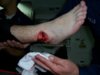 iczorro ankle(a).jpg