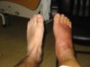 iczorro ankle(b).jpg