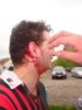 head wound2.jpg
